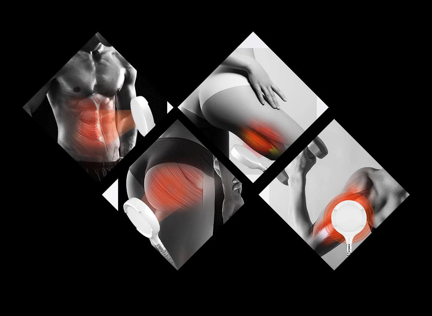 Electromagnetic Muscle Stimulation